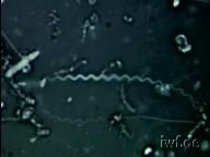 loca americana agentul patogen locii americane este bacillus larvae.