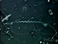 loca americana - Agentul patogen al locii americane este bacillus - TRATAMENTE
