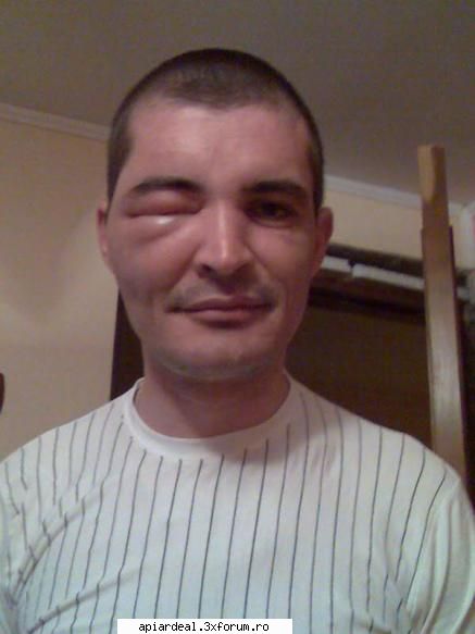 ochiul si pepenele - ciptheman - SUNT INCEPATOR